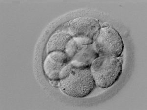 Embrião no terceiro dia - Fertilização in vitro e inseminação artificial são sinônimos? - Doutor Armindo Dias Teixeira
