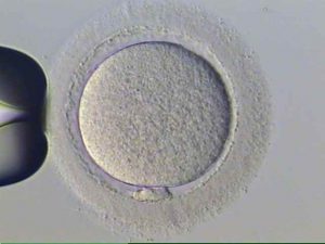 Óvulo maduro - Fertilização in vitro e inseminação artificial são sinônimos? - Doutor Armindo Dias Teixeira