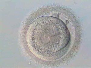 Fertilização: presença de 2 pro núcleos - Fertilização in vitro e inseminação artificial são sinônimos? - Doutor Armindo Dias Teixeira