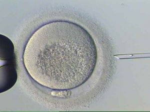 Injeção intracitoplasmática de espermatozoide - Fertilização in vitro e inseminação artificial são sinônimos? - Doutor Armindo Dias Teixeira