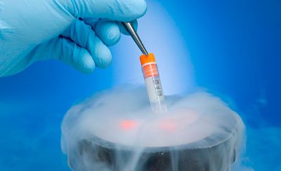 Como é o congelamento de embriões, óvulos, sêmen e tecidos?